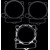 Комплект гарнитури race KTM/HUS ATHENA R2706-090 Комплект гарнитури race KTM/HUS ATHENA R2706-090 thumb